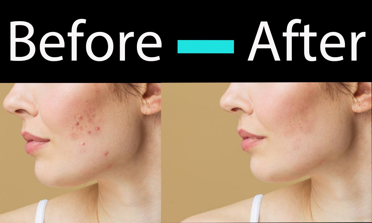I will do dust spot pimple Dark circles Clear from im...