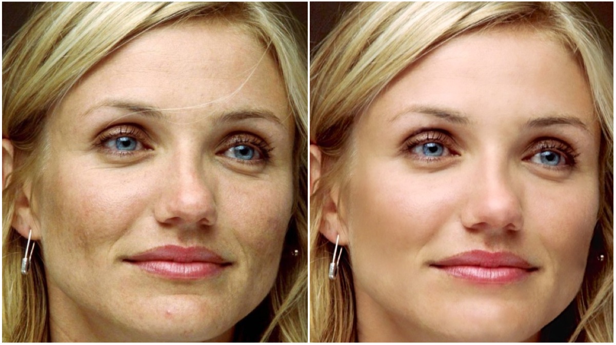 I will remove blemishes and improve skin to three of ...