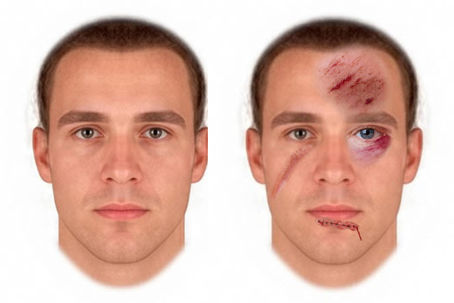 I AM ABLE TO MAKE YOUR FACE LOOK APPEAR IN A SERIOUS ACCIDENT OR FIGHT, FROM A PHOTO YOU SUPPLY