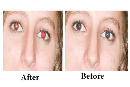 I will do 05 remove red eye or Remove Background