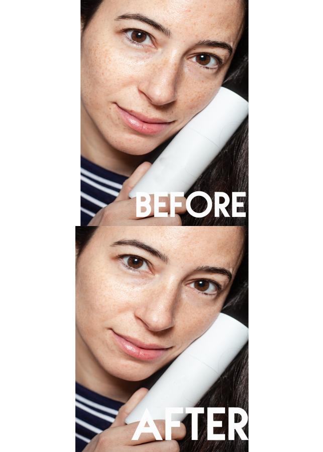 Skin Spots and Defects Gone Forever!