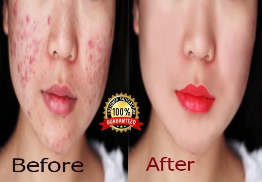 I will do professional photo retoucher, object, spot and background remover.
