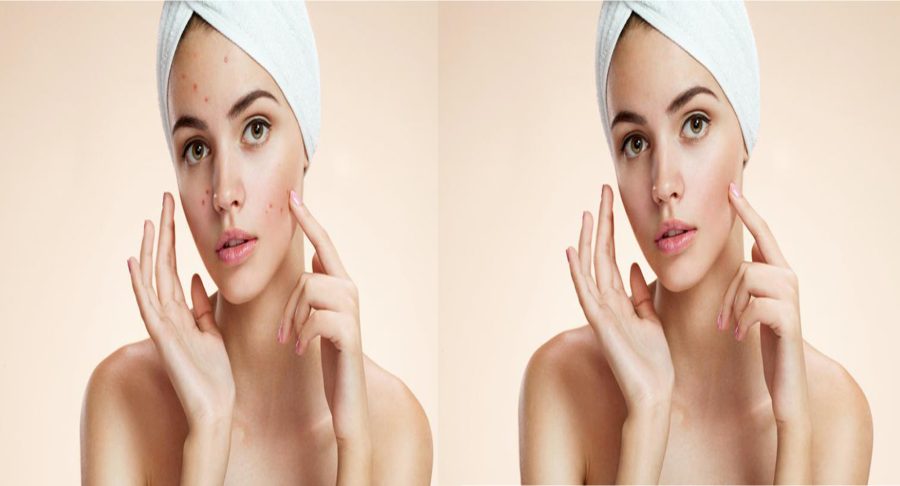I will retouch your photo accurately