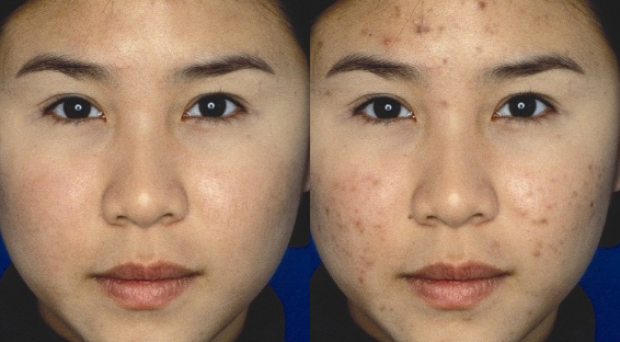 I will do 10 Image Retouch, Photo Editing and Background remove for you