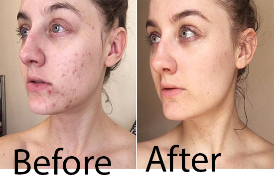 I will give you beautiful image editing, background remove or change background.