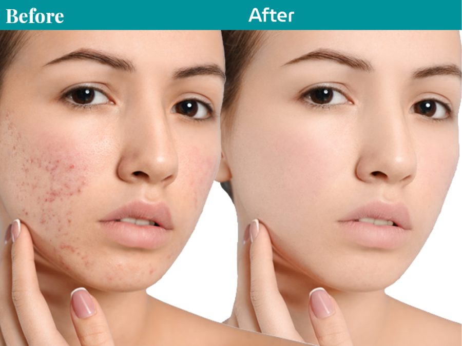 You will get Nice Photo editing & Image retouching very fast