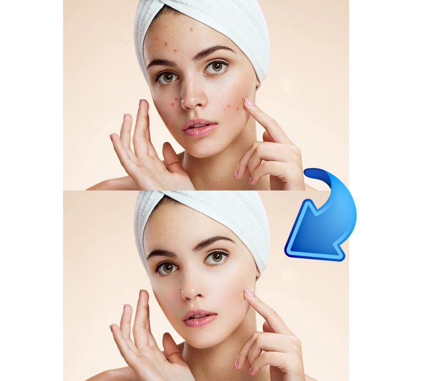 I will remove pimple, spot, face and color change from your photos
