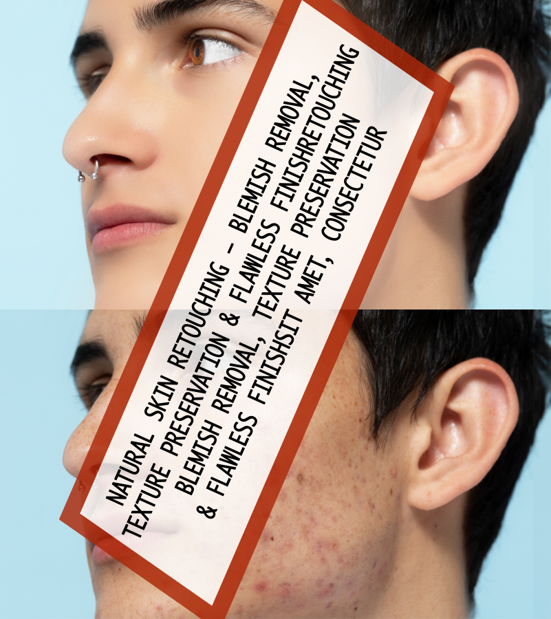 Natural Skin Retouching &ndash; Blemish Removal, Texture Preservation & Flawless Finish