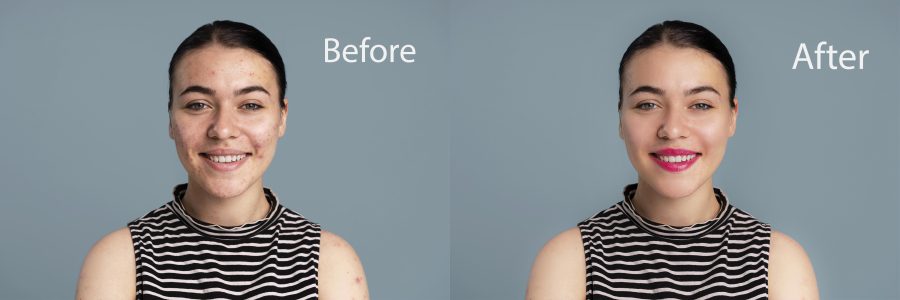 Professional photo retouching: acne removal, skin smoothing, color correction, makeup enhancement