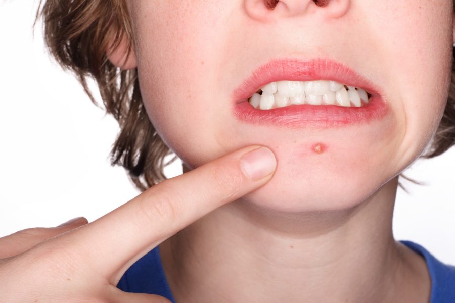 I WILL REMOVE YOUR ACNE&WRINKLES ON PHOTOSHOP PROFESSIONA  