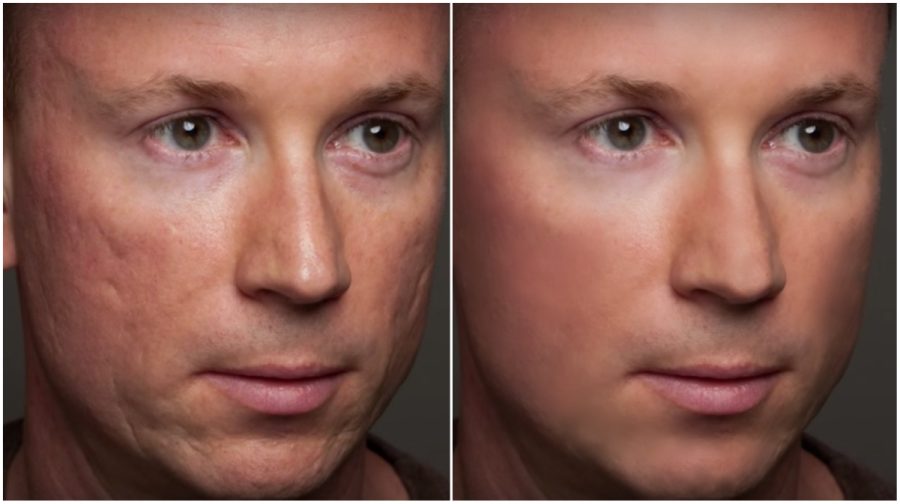 I will remove blemishes and improve skin to three of your photos