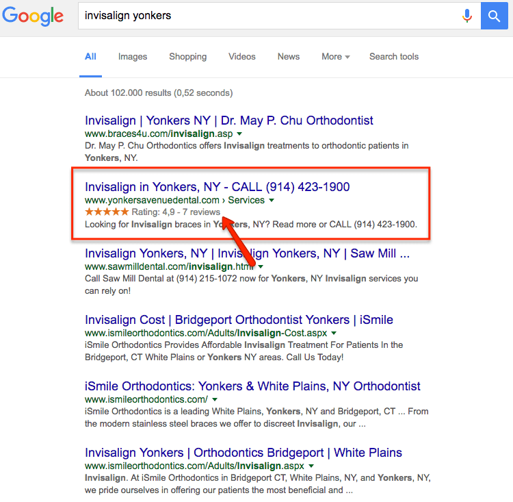Create Schema For Your Local Business Website