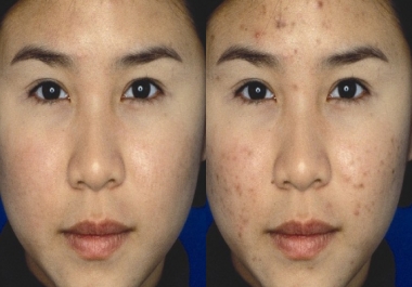 I will do 10 Image Retouch,  Photo Editing and Background remove for you