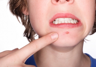 I WILL REMOVE YOUR ACNE& WRINKLES ON PHOTOSHOP PROFESSIONA